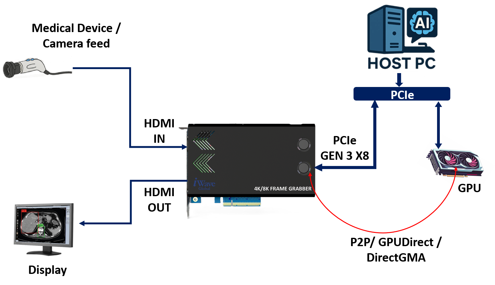 iWave’s Frame Grabber in Medical Imaging